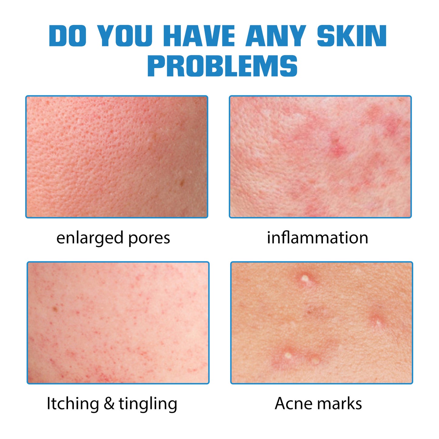 Hyaluronic Acid Replenishment