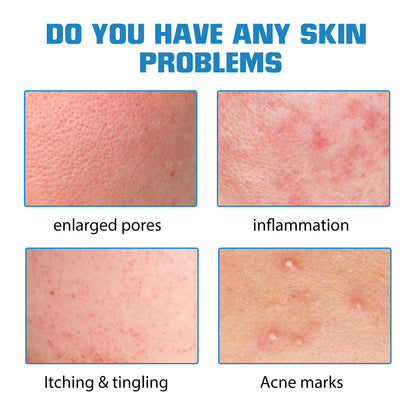 Hyaluronic Acid Replenishment